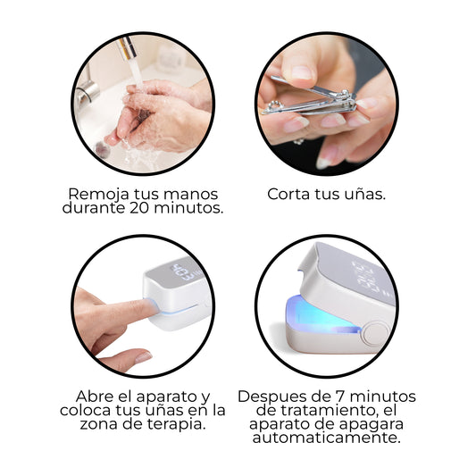 Laser De Hongos En Las Unas